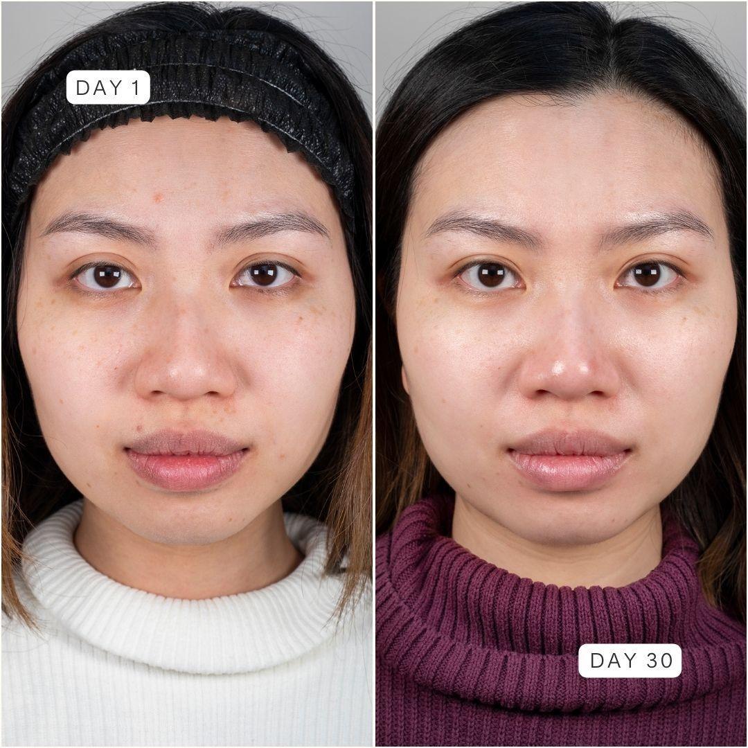 Ultimate Hydration Starter Kit Plus FREE Personalised Skin Analysis - Day & Night Cream Duo with Bio-Retinoid, Pre- & Postbiotics, Hyaluronic Acid and Vitamin C for Smoother, Stronger, More Radiant Skin