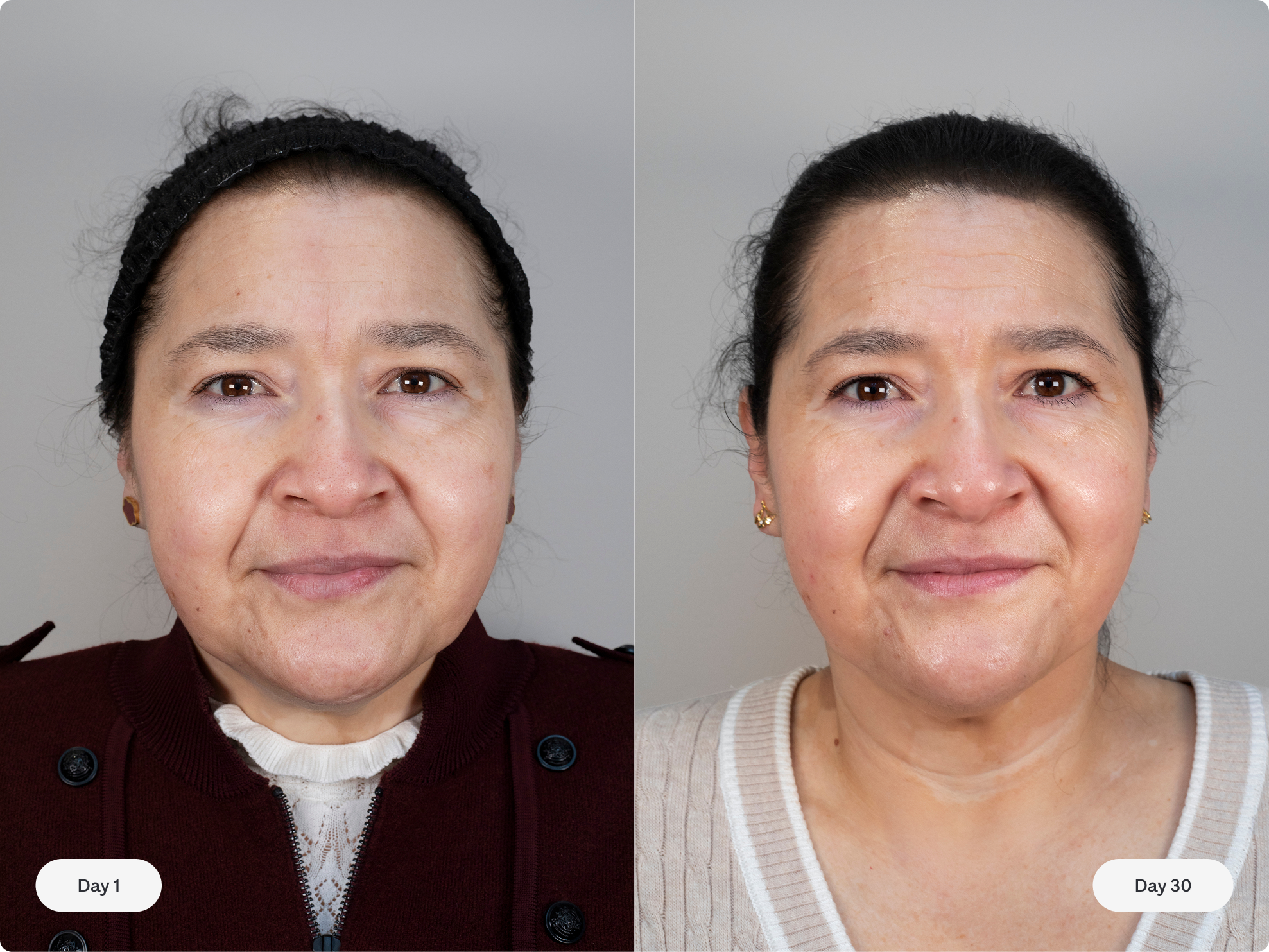 Skincare Duo